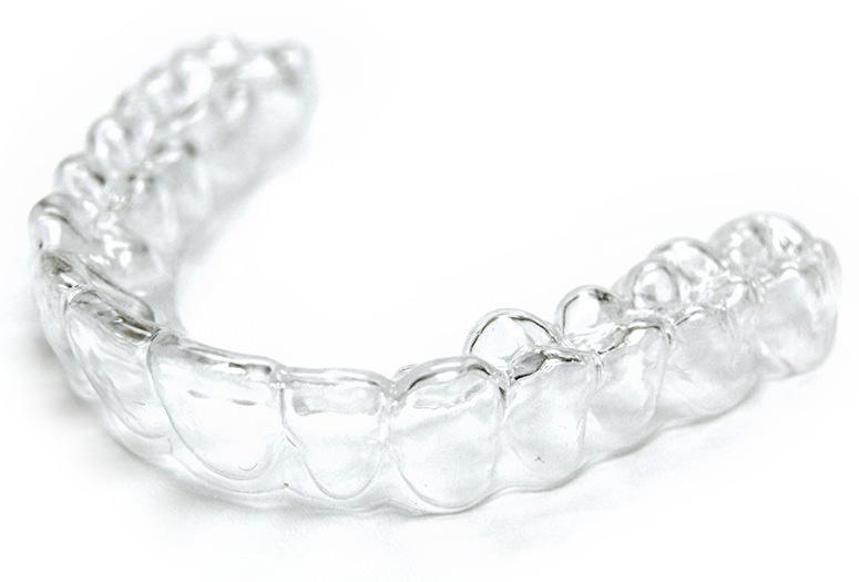 10 things you should know about Invisible braces